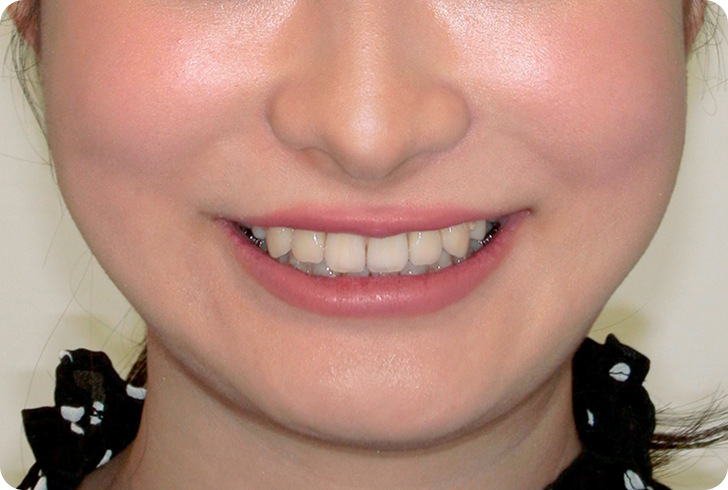 治療後