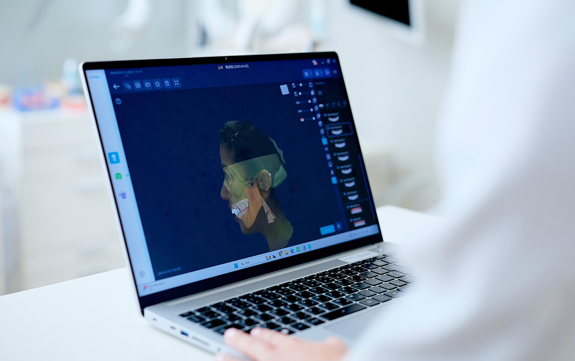 3Dデジタル診断の様子